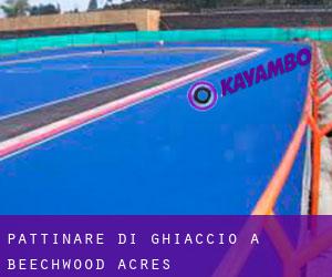 Pattinare di ghiaccio a Beechwood Acres